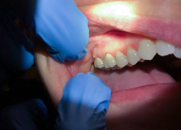 Best Emergency TMJ Treatment in Lodi, WI