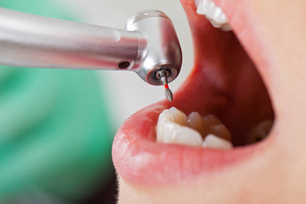 Best Emergency Treatment for Dental Infections or Abscesses in Lodi, WI